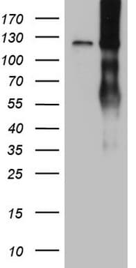 LPIN1 / Lipin 1 Antibody (aa1-274, clone OTI2C8)
