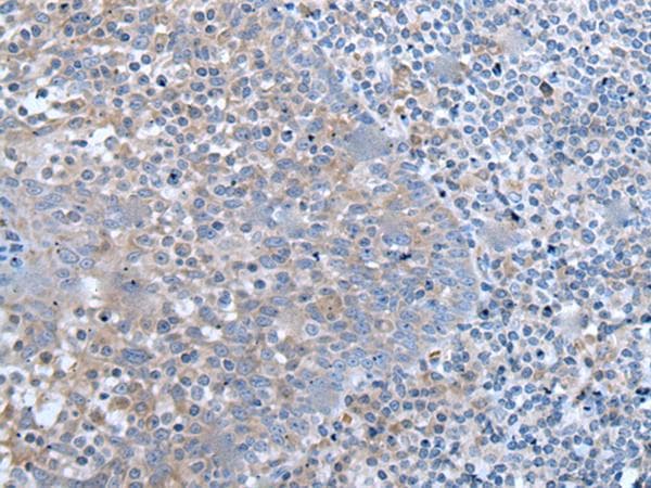 ZIC / ZIC1 Antibody