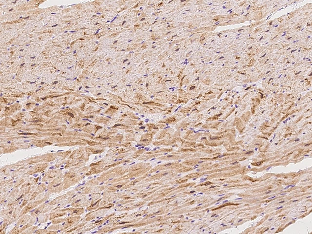 LMOD2 Antibody