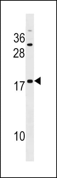 Polyclonal Rabbit anti-Human SPANXD Antibody (aa39-65, WB)