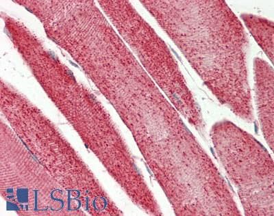 IHC-plus™ Monoclonal Mouse anti-Human ATP5B / ATP Synthase Beta Antibody (clone 6C10, IHC, WB)