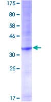 Human POT1 Protein (Recombinant GST, N-terminus)