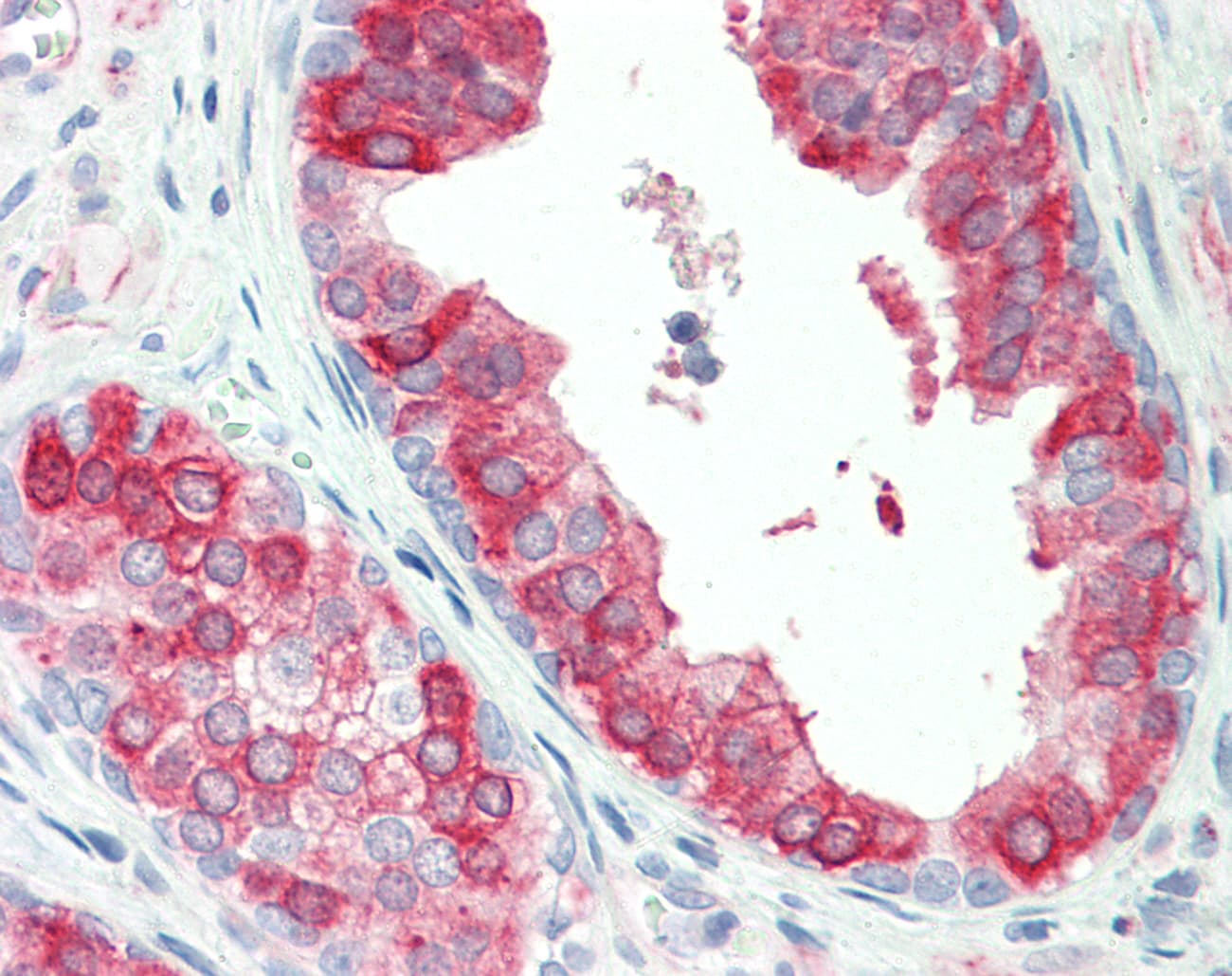 TROVE2 Antibody (aa20-69)