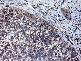 Monoclonal Mouse anti-Human CCM2 / Malcavernin Antibody (clone OTI2F9, IHC, IF, WB)