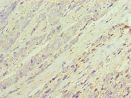 DDX / AKR1C3 Antibody (aa1-323)