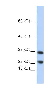 LCN8 Antibody (N-Terminus)