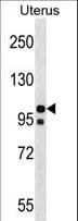 NALP4 / NLRP4 Antibody (aa121-149)
