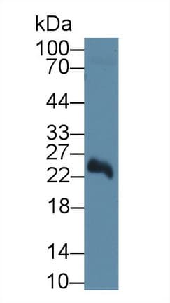 NT5M Antibody (PE)