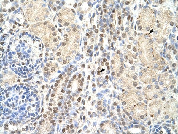 Polyclonal Rabbit anti-Human HNLF / TMED4 Antibody (N-Terminus, IHC, WB)