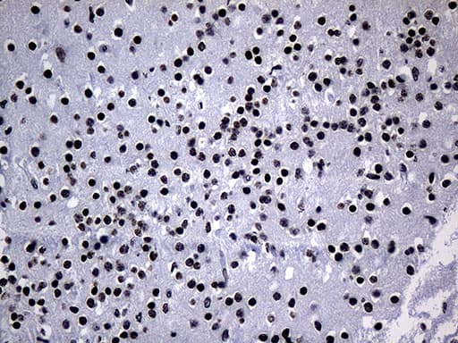 PPARD / PPAR Delta Antibody (aa1-244, clone OTI4D10, Carrier-free)
