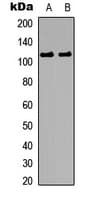 CTNND1 / p120 Catenin Antibody (phospho-Tyr228)