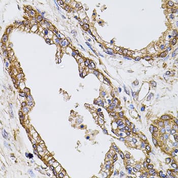 CAST / Calpastatin Antibody