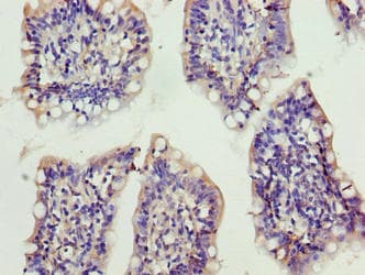 XRRA1 Antibody
