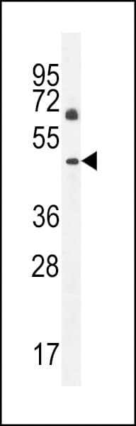 C12orf29 Antibody (aa61-89)