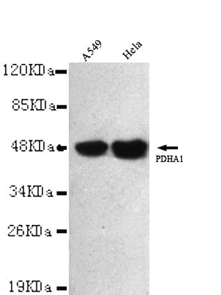 PathPlus™ PDH / Pyruvate Dehydrogenase Antibody (C-Terminus)