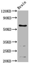 Polyclonal Rabbit anti-Human ASIC1 / ACCN2 Antibody (IF, WB)