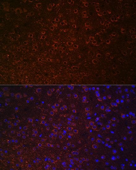 SLC6A3 / Dopamine Transporter Antibody