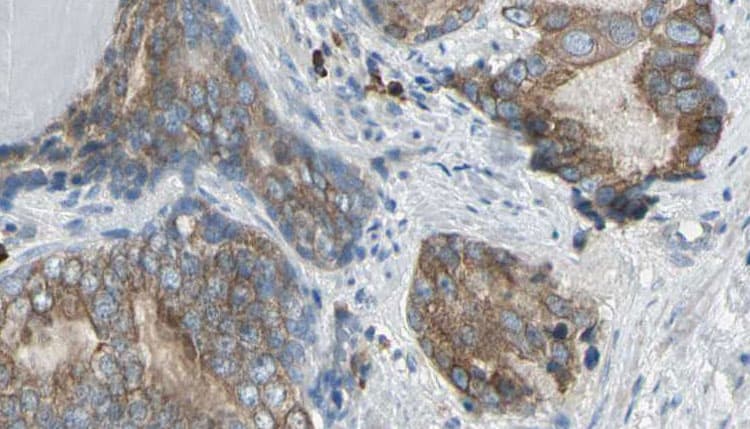 PLCG2 / PLC Gamma 2 Antibody
