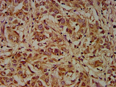Polyclonal Rabbit anti-Human DMD / Dystrophin Antibody (IHC)
