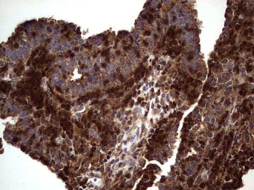 DOCK8 Antibody (aa832-1160, clone OTI4H10)