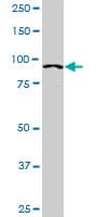 IHC-plus™ Monoclonal Mouse anti-Human ACTN4 Antibody (clone 4D10, IHC, IF, WB)
