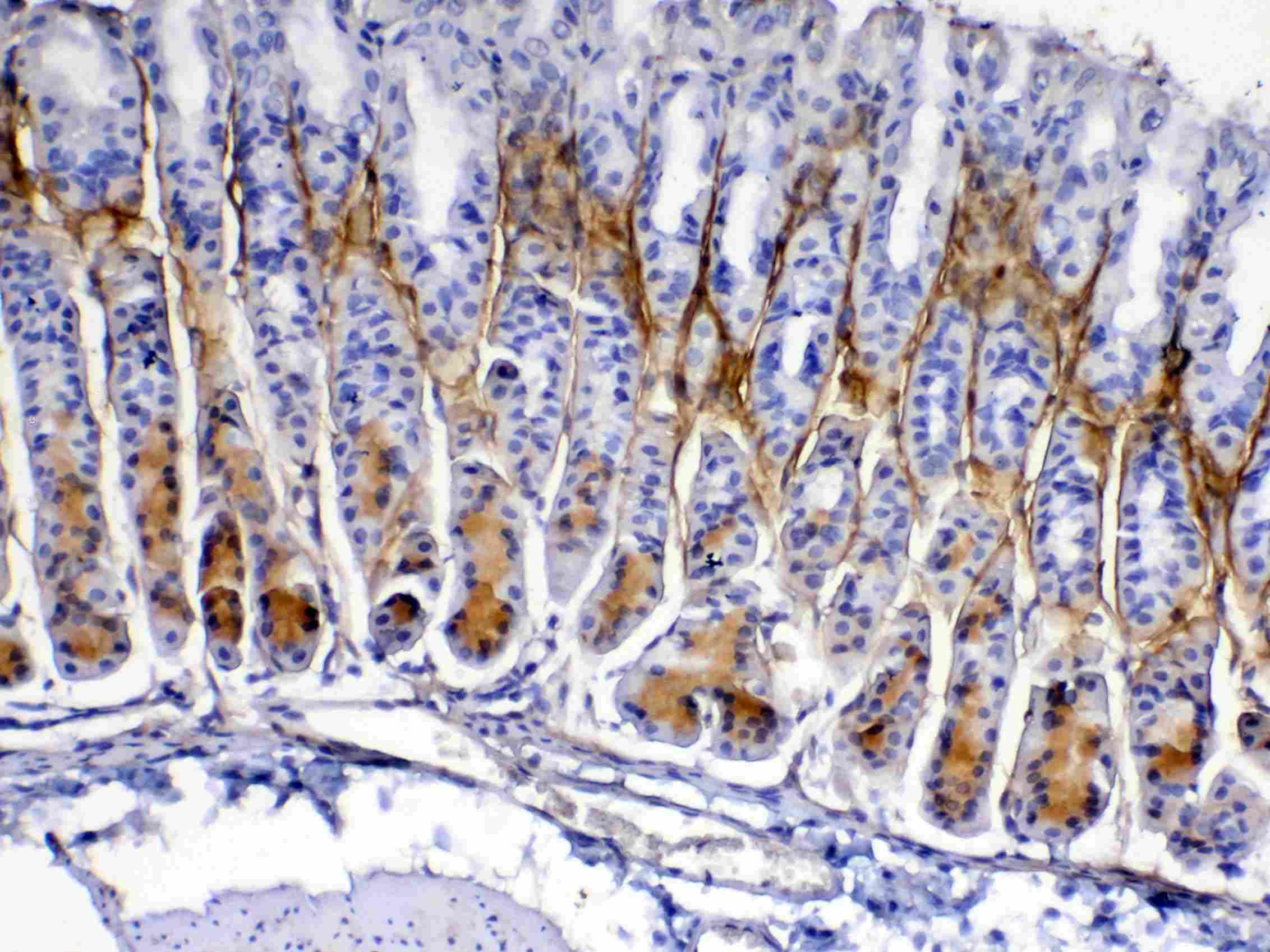 Polyclonal Rabbit anti-Rat POSTN / Periostin Antibody (IHC, WB)