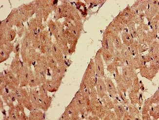 Polyclonal Rabbit anti-Human FADS1 Antibody (IHC, IF)