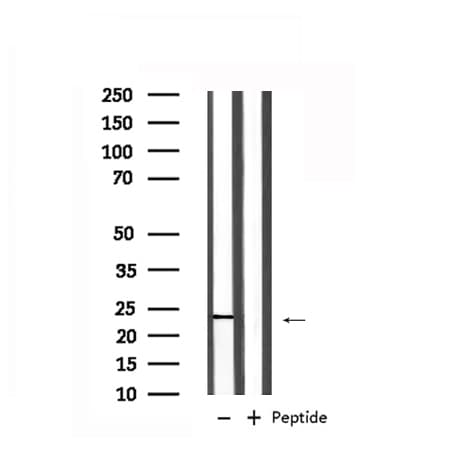Polyclonal Rabbit anti-Human RAB7A / RAB7 Antibody (IHC, WB)