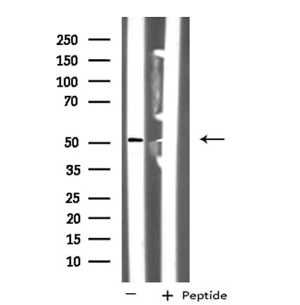 NUSAP1 / NUSAP Antibody