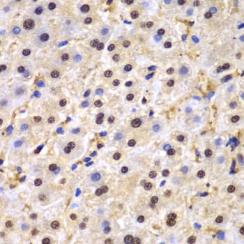 TDP-43 / TARDBP Antibody