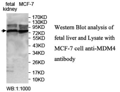 Polyclonal Rabbit anti-Human MDM4 / MDMX Antibody (aa2-113, IHC, WB)