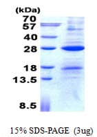 Human AICDA / AID Protein (Recombinant His)