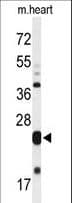 MLF1 Antibody (aa215-244)