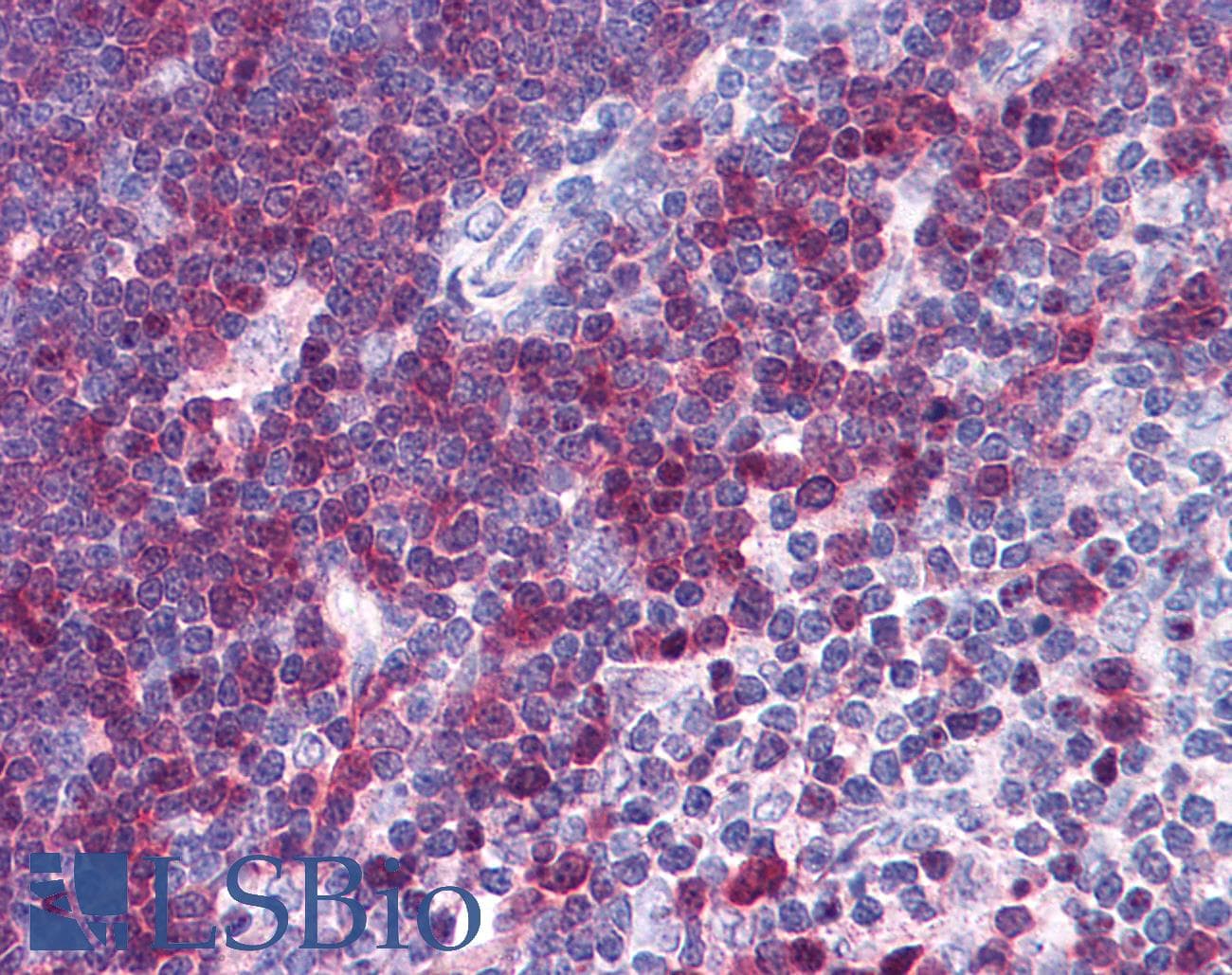 IHC-plus™ Polyclonal Goat anti-Human STMN1 / Stathmin / LAG Antibody (aa135-149, IHC, WB)