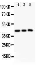 SIRT2 / Sirtuin 2 Antibody (aa165-187)