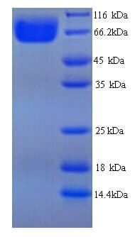 Aspergillus niger 3-Phytase A Protein (Recombinant His)