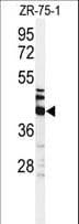 KRT35 / Keratin 35 / KRTHA5 Antibody (aa352-380)