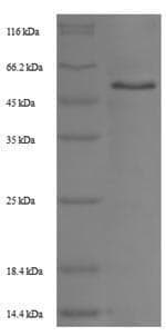 Rat TPBG / 5T4 Protein (Recombinant 6His-SUMO, N-terminus)
