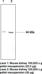 Polyclonal Rabbit anti-Human HSD2 / HSD11B2 Antibody (WB)