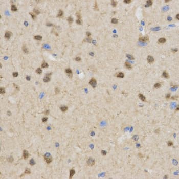TLE1 / TLE 1 Antibody