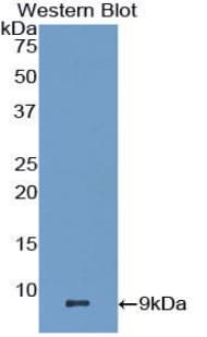 CCL22 / MDC Antibody (aa29-92)