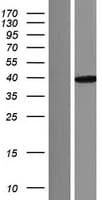 Junctin / ASPH Protein (Over-Expression Lysate Myc-DDK (Flag))
