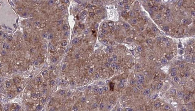 OR2A2 Antibody