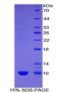 Mouse UCN2 / SRP Protein (Recombinant His)