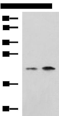 CHMP6 Antibody