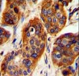 LRRC57 Antibody (aa198-227)