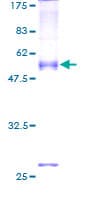 Human SEC22L2 / SEC22A Protein (Recombinant GST)