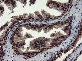 Mannose Phosphate Isomerase Antibody (clone OTI4G7)