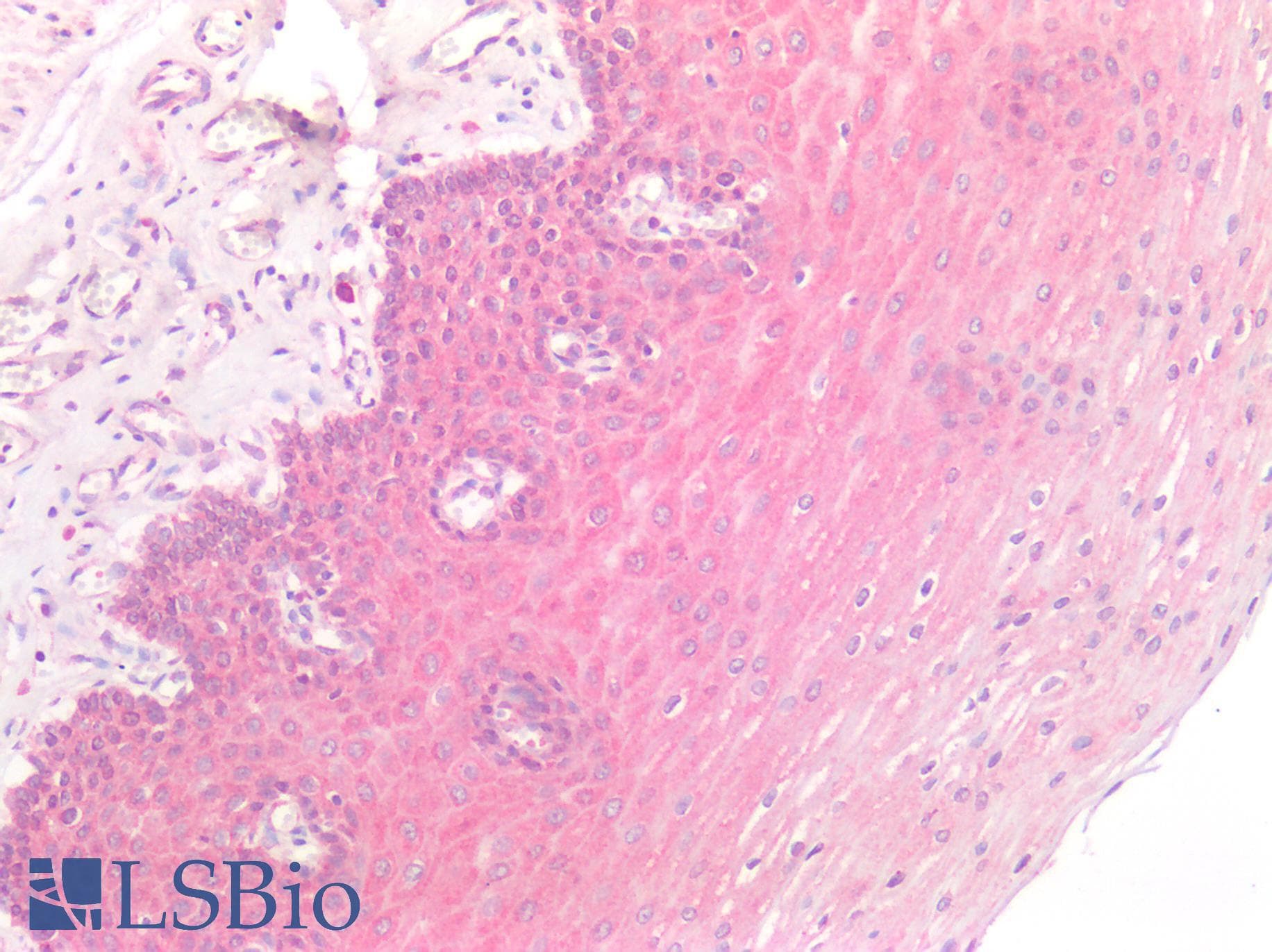 PathPlus™ GRB7 Antibody