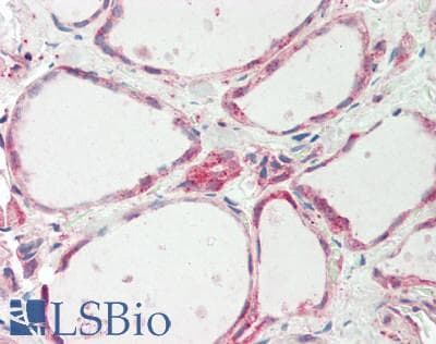 Polyclonal Rabbit anti-Human ATE1 Antibody (aa432-481, IHC, WB)